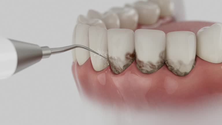 Reliable Dental contractor in Liverpool, NY by Smile Center Dentistry
